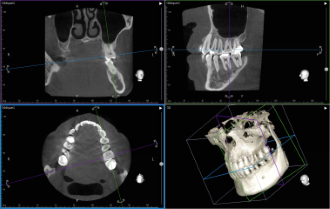 アーム型X線CT診断装置写真