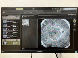 眼底三次元画像解析OCT