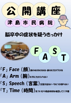 脳卒中を疑うきっかけ「FAST」とは